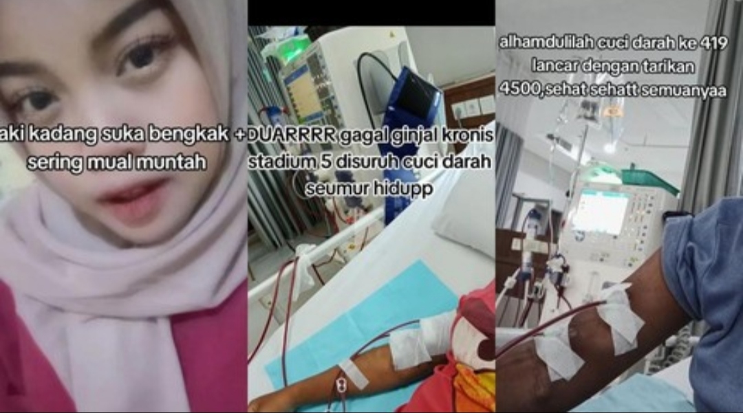 Kolase foto Sulistia remaja 18 tahun pasien gagal ginjal stadium 5 asal Tangerang. Kiri: Wajah Sulistia saat menceritakan gejala awal bengkak dan mual. Tengah dan Kanan: Dokumentasi proses cuci darah (hemodialisis) rutin di rumah sakit dengan selang terpasang di lengan.